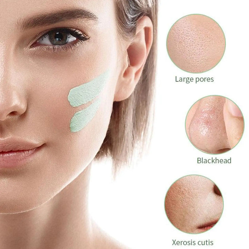 Green Mask Stick Tira Acne Espinhas Limpa Pele E Hidrata